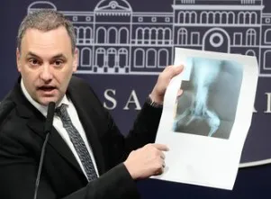 Adorni pensiones truchas