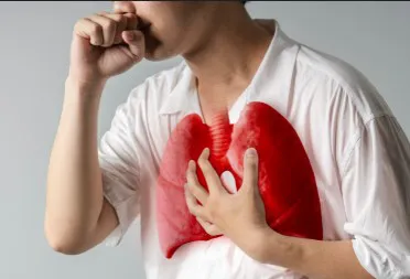 tuberculosis