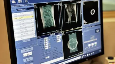 Imagenes de alta complegidad resonador